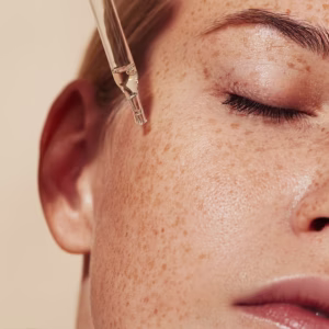 Hyperpigmentation